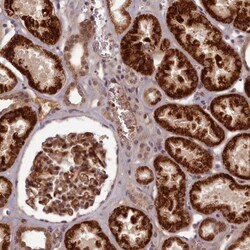 EARS2 Antibody, Novus Biologicals 0.1mL; Unlabeled:Antibodies, Polyclonal